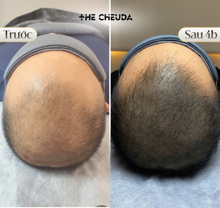 SMP Biotin Extra The Cheuda