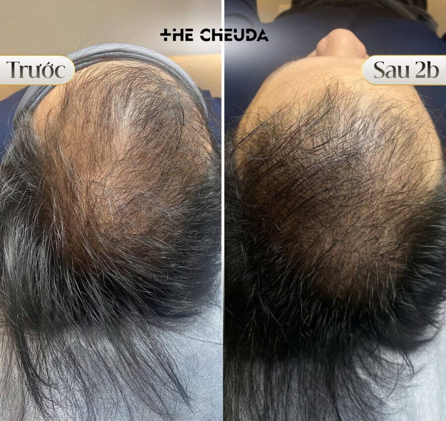 SMP Biotin Extra The Cheuda