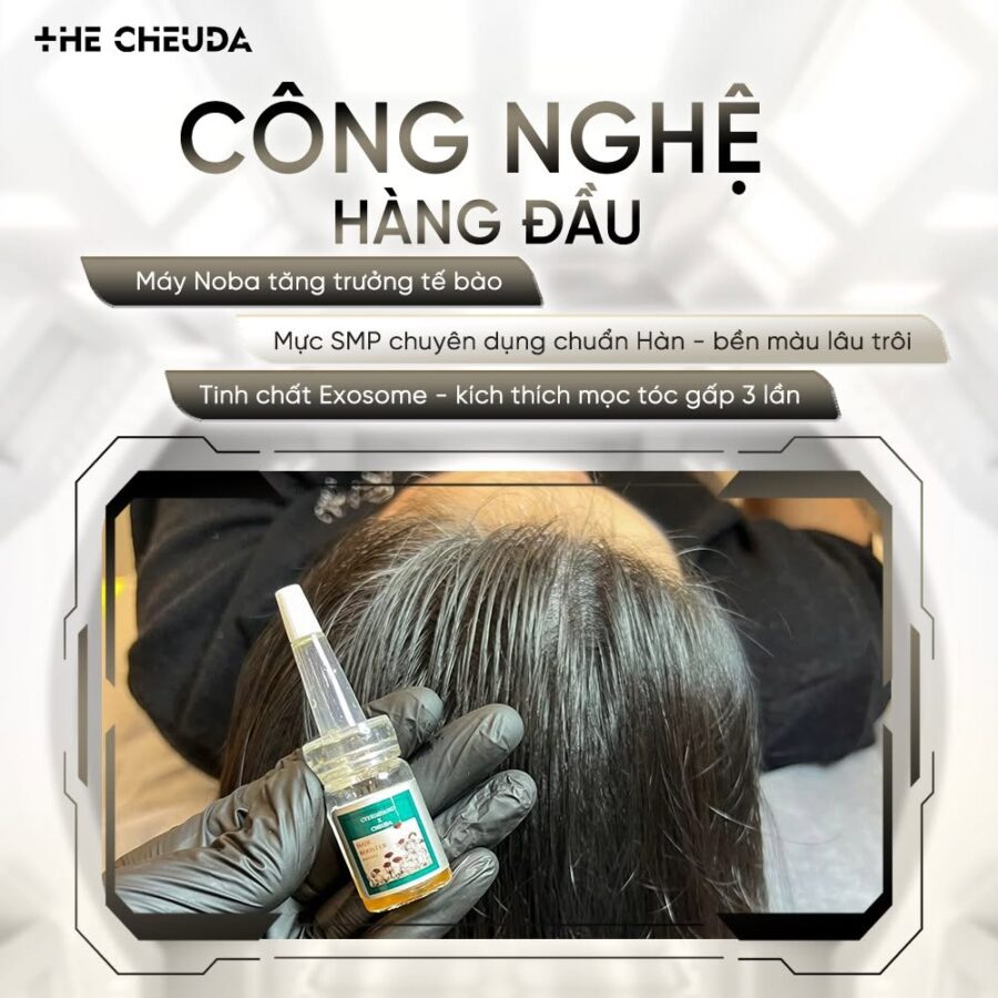 Top 7 ưu điểm của SMP vi chạm sắc tố da đầu Biotin Extra so với xăm tóc 3 SMP vi chạm sắc tố
