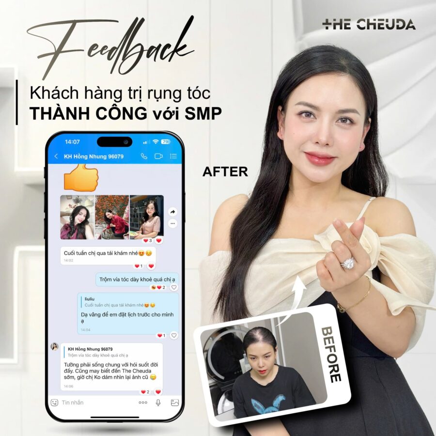SMP vi chạm sắc tố
