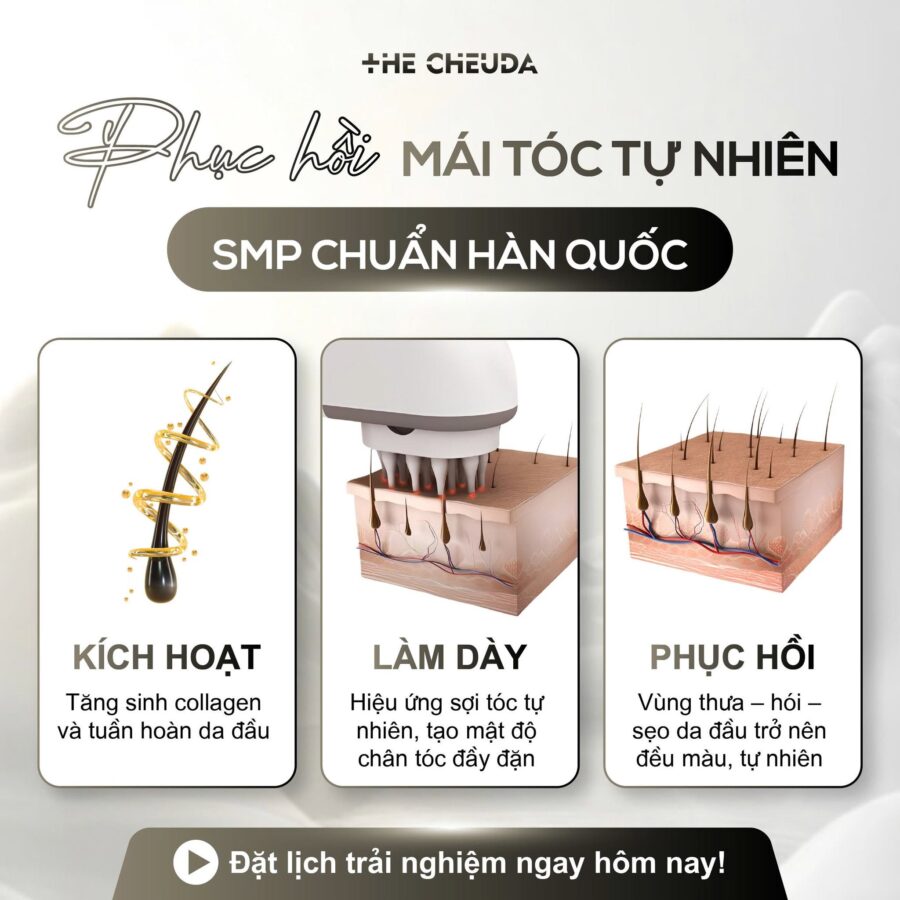 SMP vi chạm sắc tố