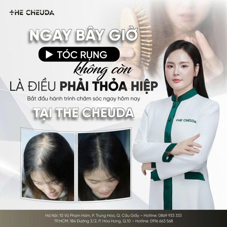 Top 7 ưu điểm của SMP vi chạm sắc tố da đầu Biotin Extra so với xăm tóc 1 SMP vi chạm sắc tố