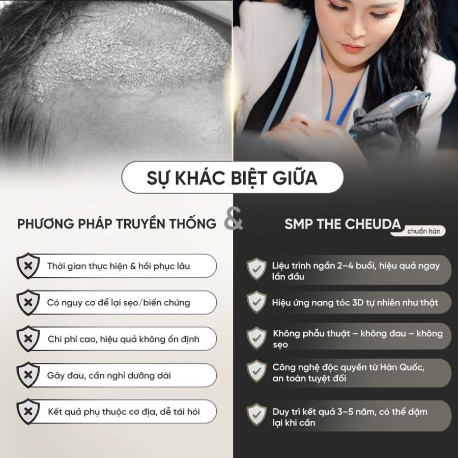 Vi chạm sắc tố da đầu SMP